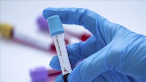 Laboratorio de MDS México donde analizarán impacto del Covid en genoma mexicano